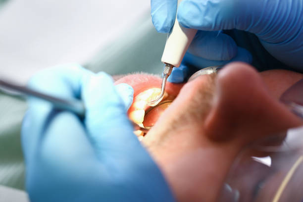Best Emergency Gum Treatment in Susan Moore, AL